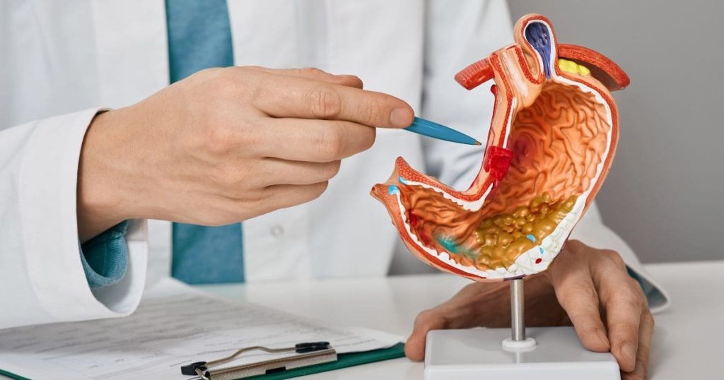 Гастроентеролог